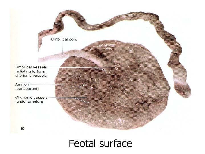 Feotal surface 