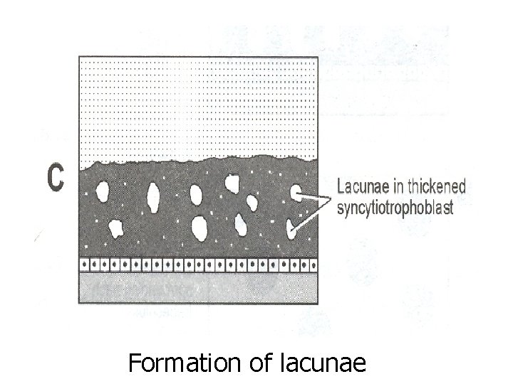 Formation of lacunae 