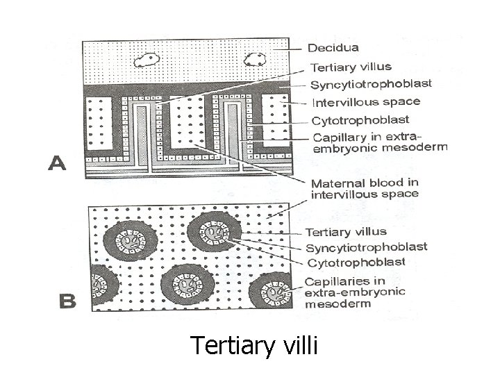 Tertiary villi 