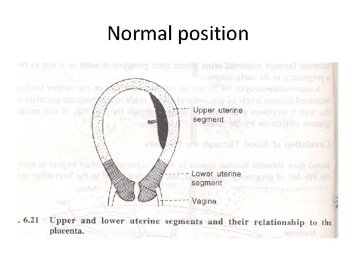 Normal position 