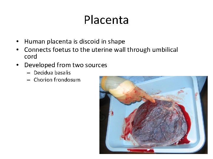 Placenta • Human placenta is discoid in shape • Connects foetus to the uterine