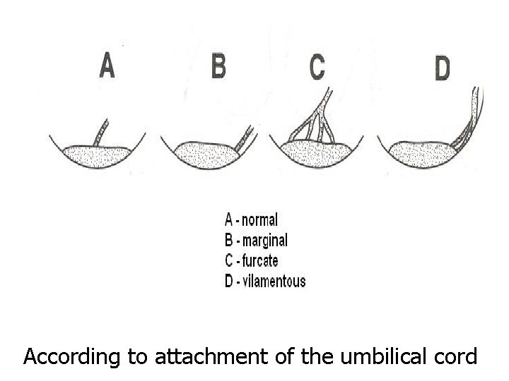According to attachment of the umbilical cord 