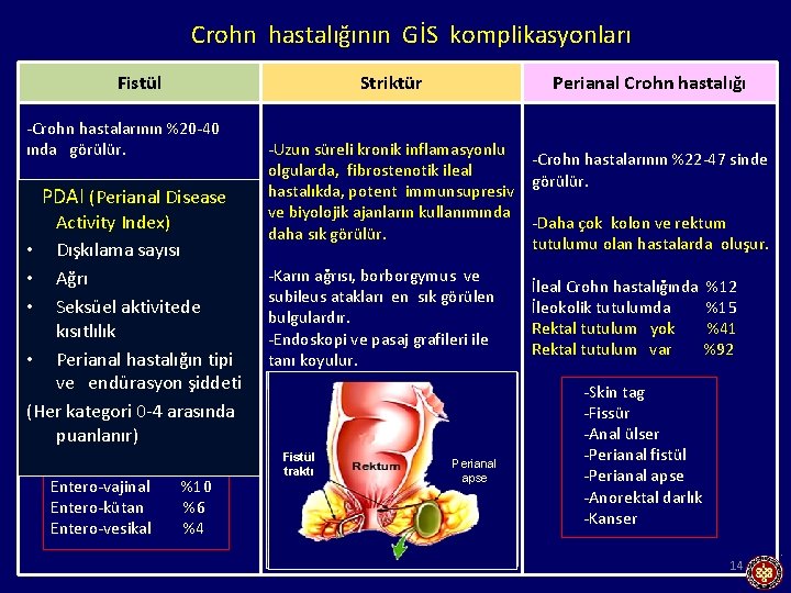 Crohn hastalığının GİS komplikasyonları Fistül -Crohn hastalarının %20 -40 ında görülür. -Fistül gelişiminde kümülatif