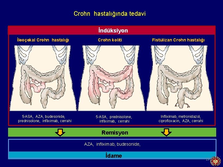 Crohn hastalığında tedavi İndüksiyon İleoçekal Crohn hastalığı 5 -ASA, AZA, budesonide, prednisolone, infliximab, cerrahi