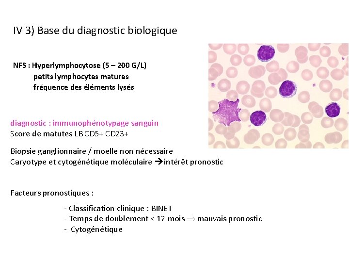 IV 3) Base du diagnostic biologique NFS : Hyperlymphocytose (5 – 200 G/L) petits