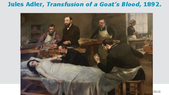 Jules Adler, Transfusion of a Goat’s Blood, 1892. 2/26/2021 9 