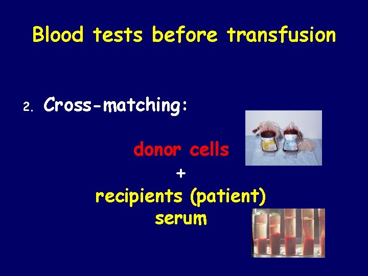 Blood tests before transfusion 2. Cross-matching: donor cells + recipients (patient) serum 
