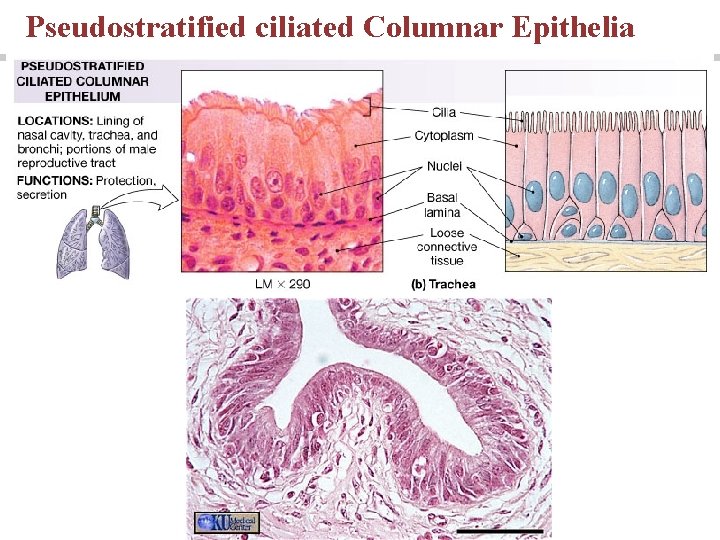 Pseudostratified ciliated Columnar Epithelia 