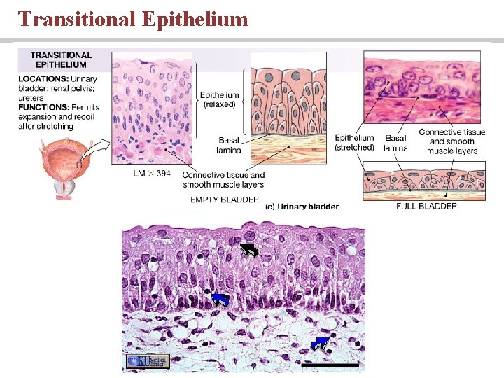 Transitional Epithelium 