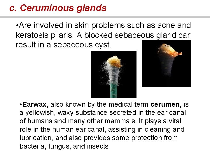 c. Ceruminous glands • Are involved in skin problems such as acne and keratosis