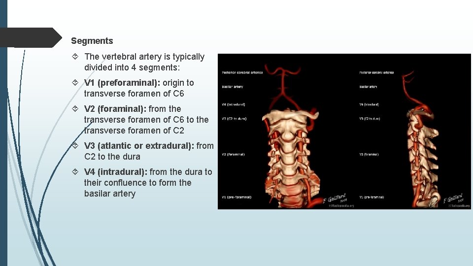 Segments The vertebral artery is typically divided into 4 segments: V 1 (preforaminal): origin