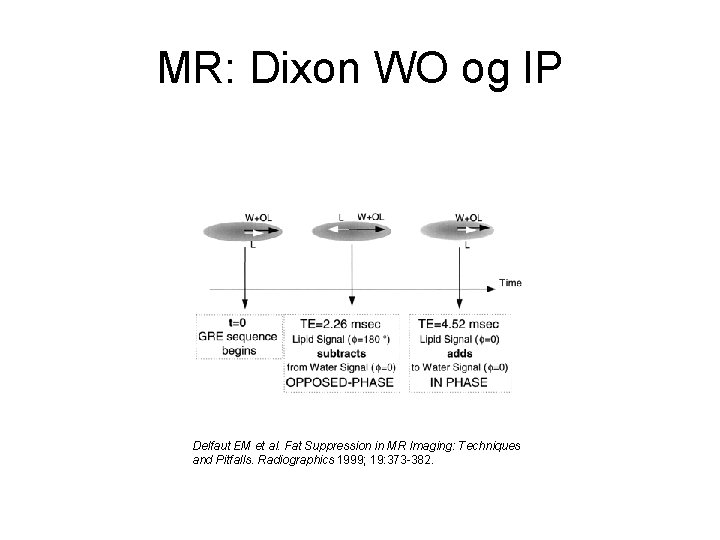 MR: Dixon WO og IP Delfaut EM et al. Fat Suppression in MR Imaging: