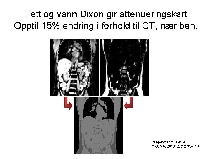 Fett og vann Dixon gir attenueringskart Opptil 15% endring i forhold til CT, nær