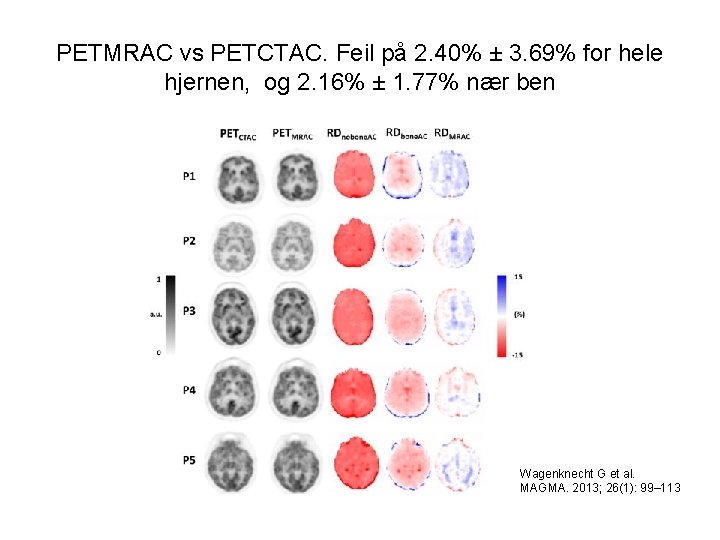 PETMRAC vs PETCTAC. Feil på 2. 40% ± 3. 69% for hele hjernen, og