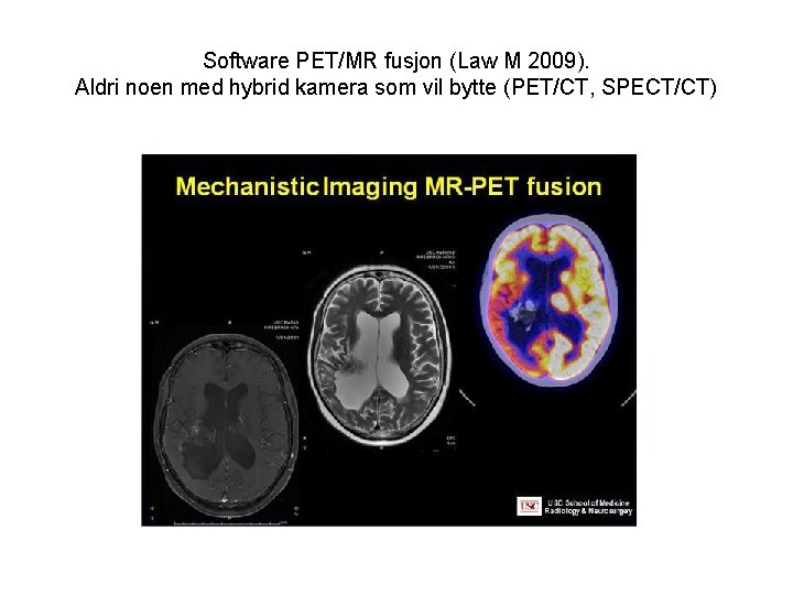 Software PET/MR fusjon (Law M 2009). Aldri noen med hybrid kamera som vil bytte
