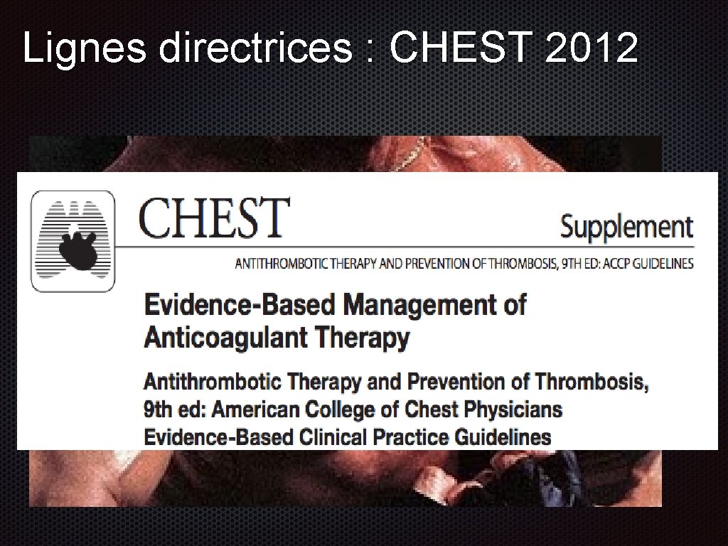 Lignes directrices : CHEST 2012 