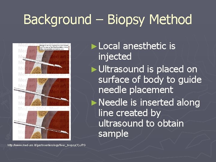 Background – Biopsy Method ► Local anesthetic is injected ► Ultrasound is placed on Background – Biopsy Method ► Local anesthetic is injected ► Ultrasound is placed on