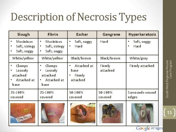 Description of Necrosis Types • • • Mucinious Soft, stringy Soft, soggy Fibrin •