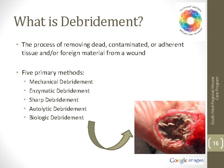 What is Debridement? • The process of removing dead, contaminated, or adherent tissue and/or