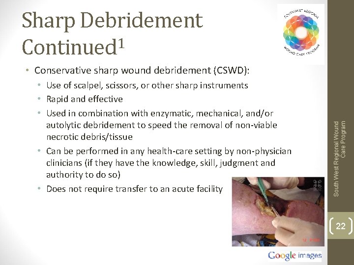 Sharp Debridement Continued 1 • Use of scalpel, scissors, or other sharp instruments •