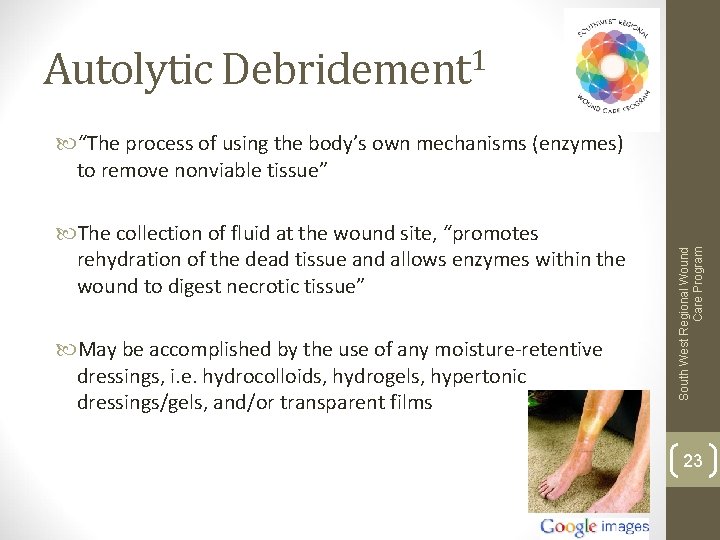 Autolytic Debridement 1 The collection of fluid at the wound site, “promotes rehydration of