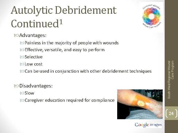 Autolytic Debridement Continued 1 Painless in the majority of people with wounds Effective, versatile,