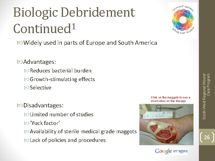 Biologic Debridement Continued 1 Widely used in parts of Europe and South America Reduces