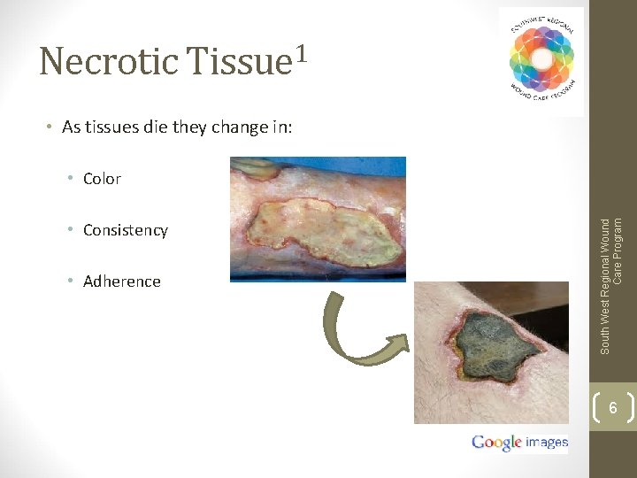 Necrotic Tissue 1 • As tissues die they change in: • Consistency • Adherence