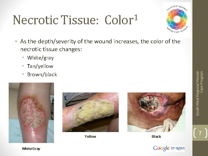 Necrotic Tissue: Color 1 • As the depth/severity of the wound increases, the color