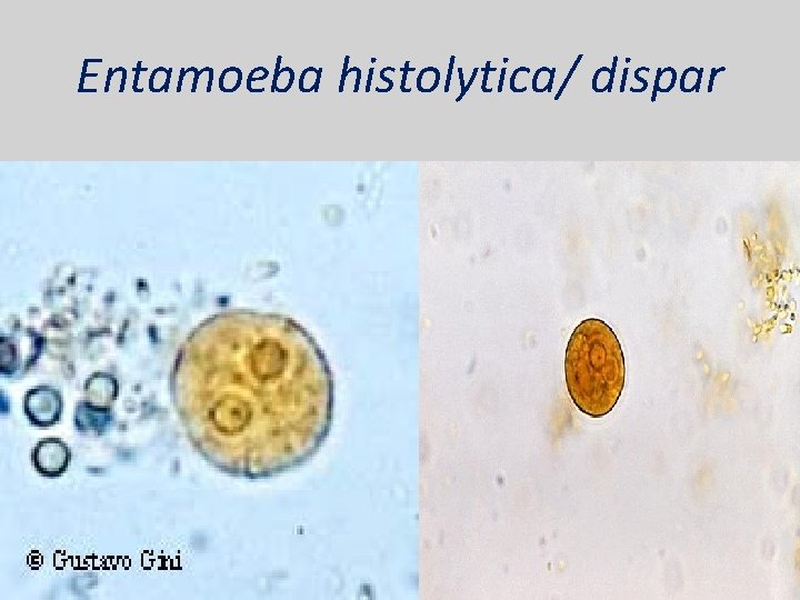 Entamoeba histolytica/ dispar 