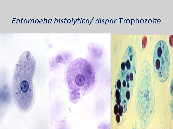 Entamoeba histolytica/ dispar Trophozoite 