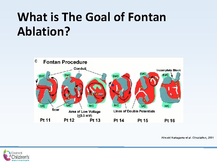 What is The Goal of Fontan Ablation? Hiroshi Nakagawa et al. Circulation, 2001 