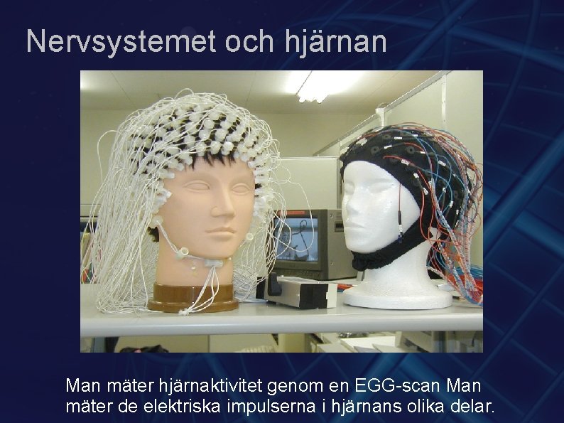 Nervsystemet och hjärnan Man mäter hjärnaktivitet genom en EGG-scan Man mäter de elektriska impulserna