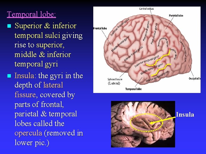 Temporal lobe: n Superior & inferior temporal sulci giving rise to superior, middle &