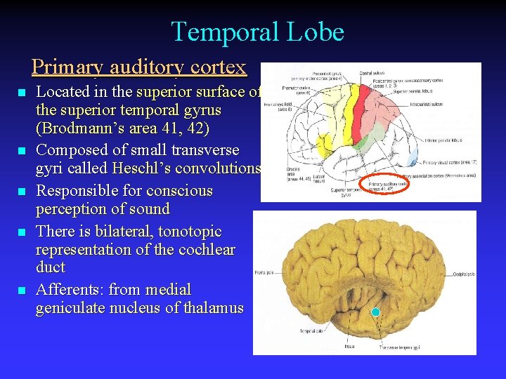 Temporal Lobe Primary auditory cortex n n n Located in the superior surface of