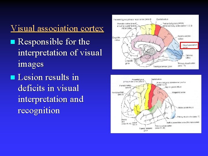 Visual association cortex n Responsible for the interpretation of visual images n Lesion results