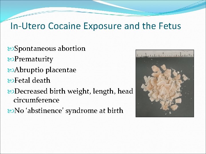 In-Utero Cocaine Exposure and the Fetus Spontaneous abortion Prematurity Abruptio placentae Fetal death Decreased