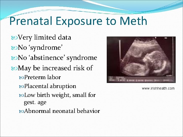 Prenatal Exposure to Meth Very limited data No ‘syndrome’ No ‘abstinence’ syndrome May be