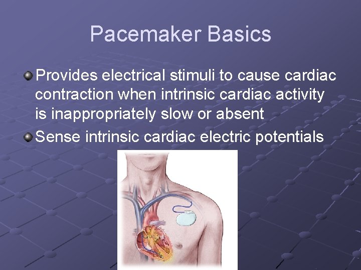 Pacemaker Basics Provides electrical stimuli to cause cardiac contraction when intrinsic cardiac activity is