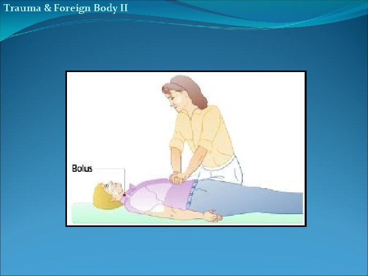 Trauma & Foreign Body II 