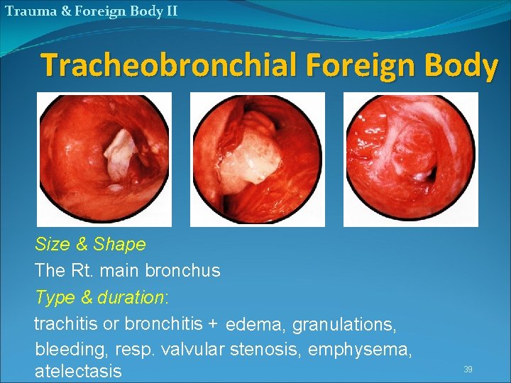Trauma & Foreign Body II Tracheobronchial Foreign Body Size & Shape The Rt. main