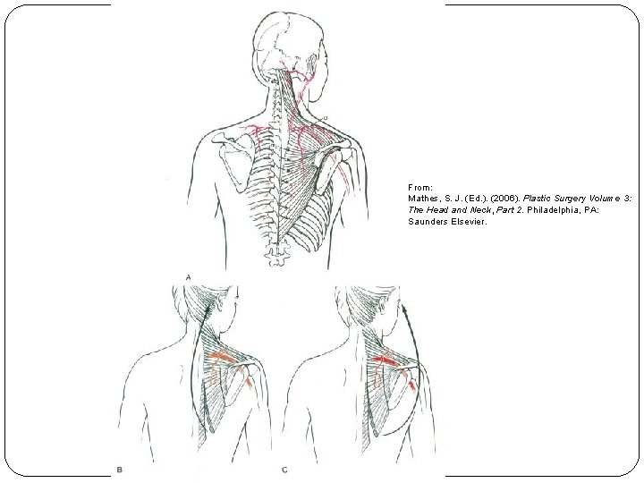 From: Mathes, S. J. (Ed. ). (2006). Plastic Surgery Volume 3: The Head and