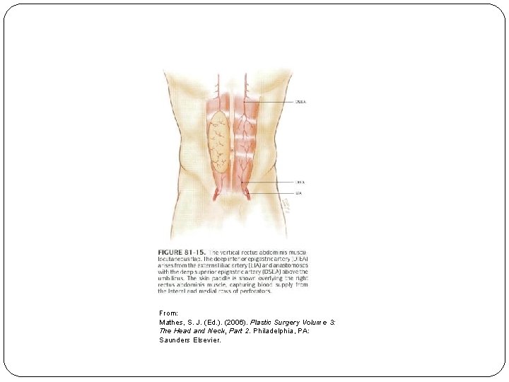 From: Mathes, S. J. (Ed. ). (2006). Plastic Surgery Volume 3: The Head and
