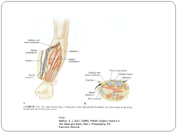 From: Mathes, S. J. (Ed. ). (2006). Plastic Surgery Volume 3: The Head and
