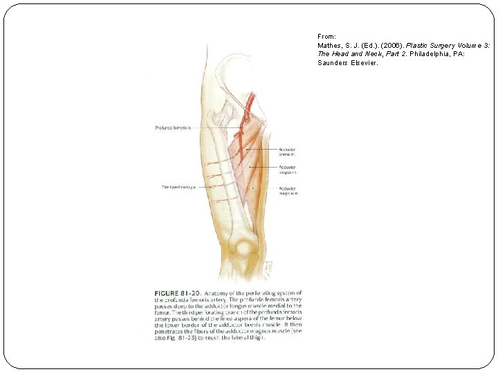 From: Mathes, S. J. (Ed. ). (2006). Plastic Surgery Volume 3: The Head and