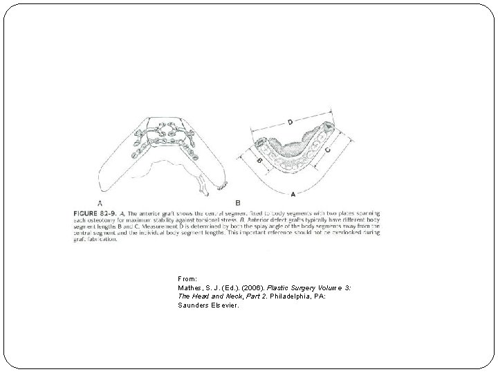 From: Mathes, S. J. (Ed. ). (2006). Plastic Surgery Volume 3: The Head and