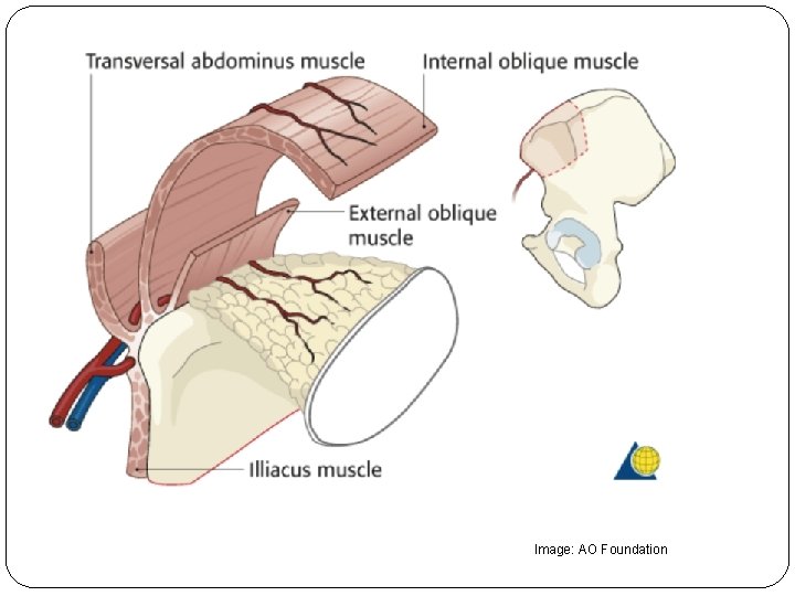 Image: AO Foundation 
