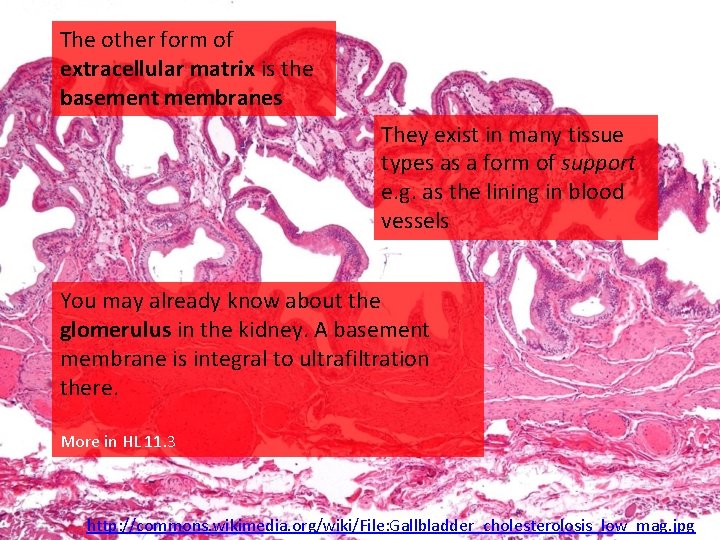 The other form of extracellular matrix is the basement membranes They exist in many