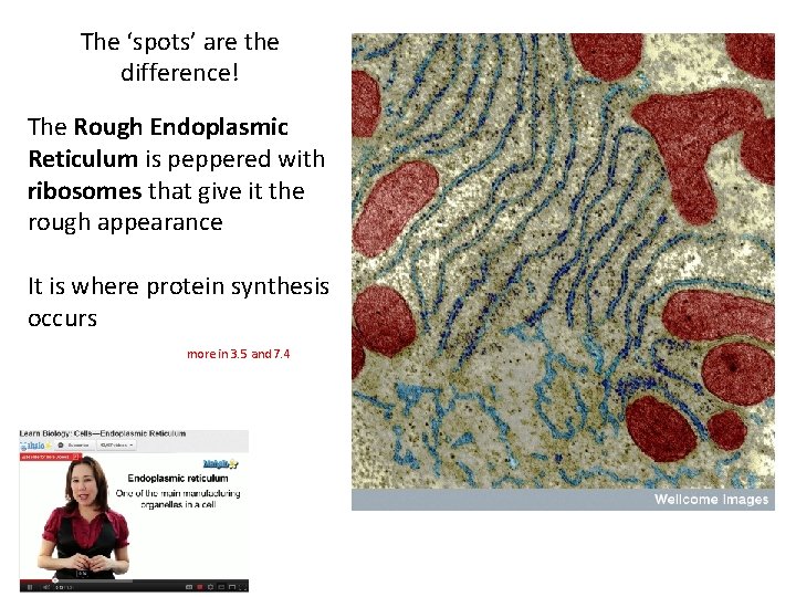 The ‘spots’ are the difference! The Rough Endoplasmic Reticulum is peppered with ribosomes that