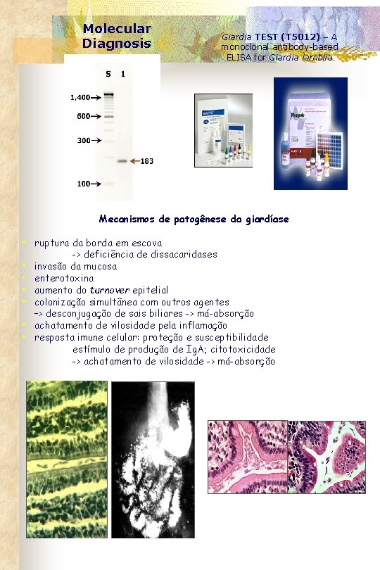 Molecular Diagnosis Giardia TEST (T 5012) – A monoclonal antibody-based ELISA for Giardia lamblia